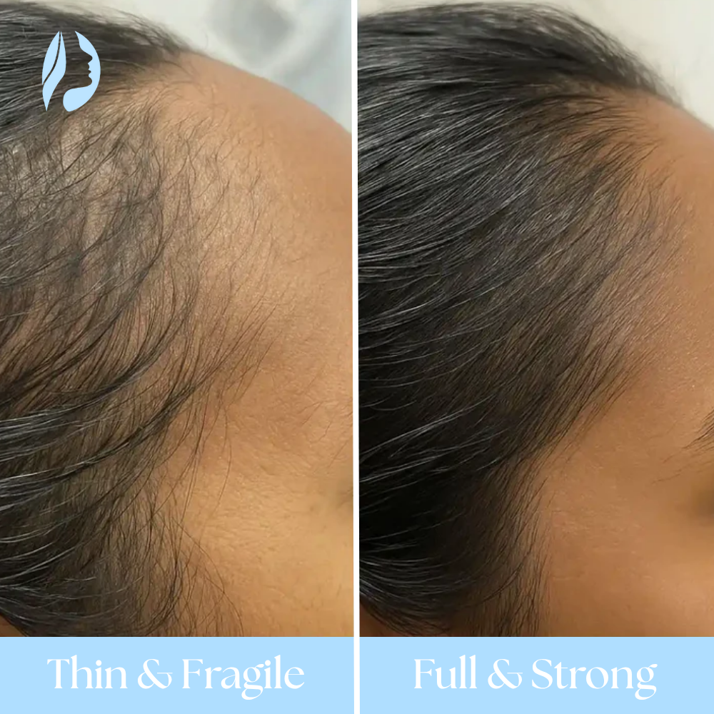 TheraBrush Smart 4 in 1 - Scalp Therapy Brush