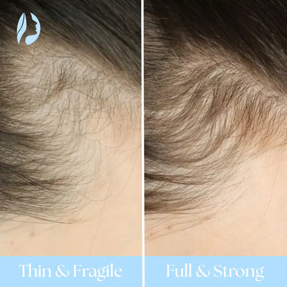 AuraBrush 4-in-1 + Rosemary Scalp Oil – Complete Therapy