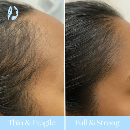 AuraBrush 4-in-1 + Rosemary Scalp Oil – Complete Therapy